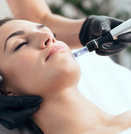 Giana Glow Microneedling București Aviatorilor 300 Lei Arc de Triumf Giana Glow Microneedling București Aviatorilor 300 Lei Arc de Triumf